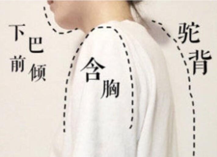 南寧美容學(xué)校：堅(jiān)持一個(gè)月，駝背變直背