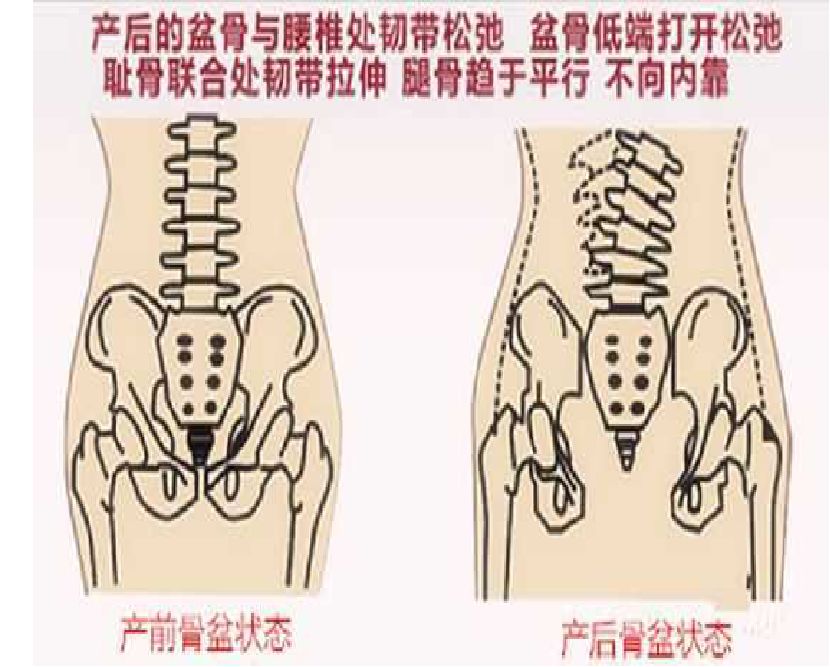 美容項(xiàng)目的另一桶金--產(chǎn)后康復(fù)師