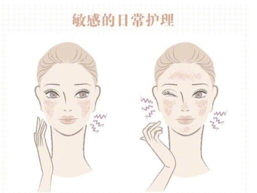 敏感肌保養(yǎng)大全！