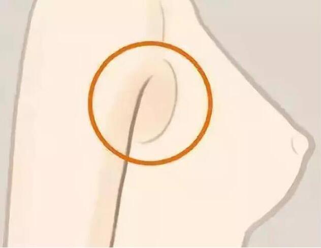 減副乳，瘦手臂一招就解決！