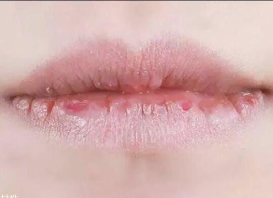 紋唇后嘴巴干燥怎么辦？南寧教紋繡的學(xué)校幫你解決