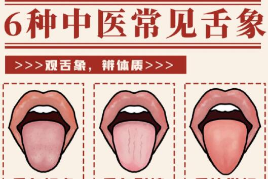 6種常見中醫(yī)舌診判定，快和廣西中醫(yī)美容一起學(xué)