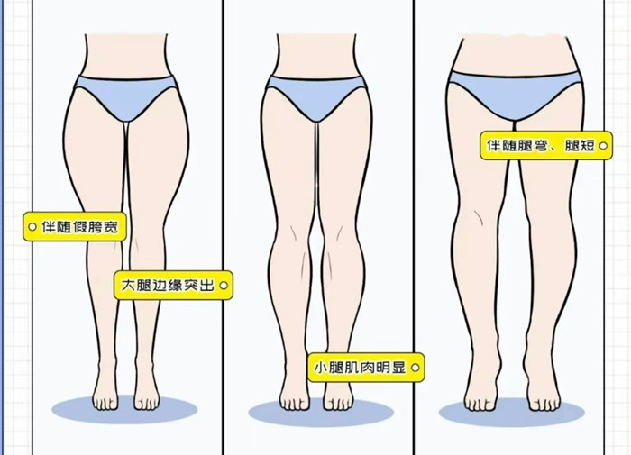 腿粗女生穿搭攻略，廣西彩妝造型搭配