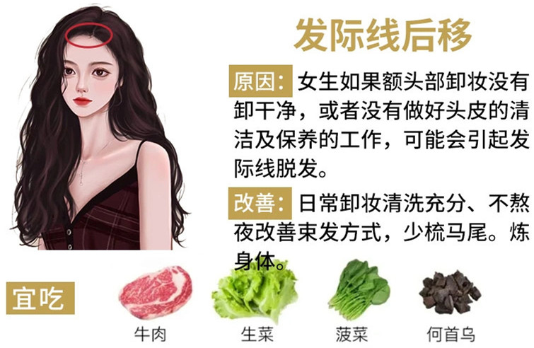 如何改善掉頭發(fā)？南寧頭療養(yǎng)發(fā)護(hù)發(fā)教學(xué)