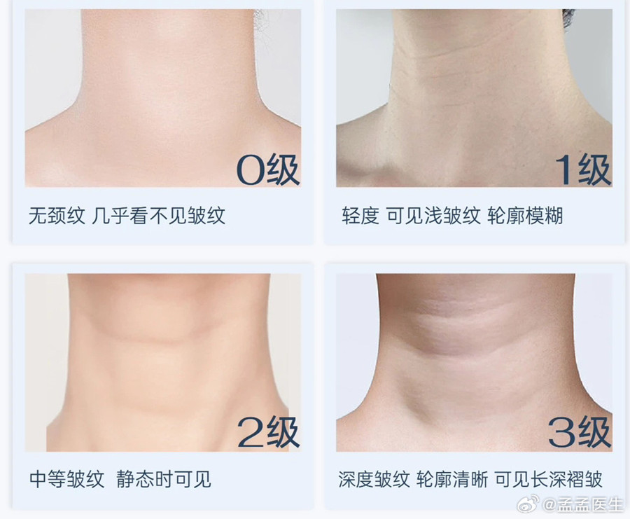 如何緩解頸紋？南寧美體美容管理培訓(xùn)