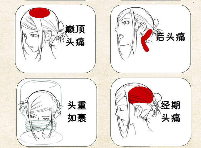 不同頭痛類型經絡護理方法，廣西中醫(yī)美容培訓