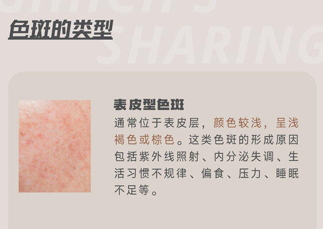 關(guān)于色斑，你需要了解這些 | 南寧皮膚管理職業(yè)學(xué)校